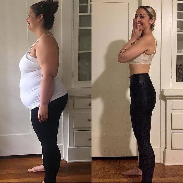 Femme avant et après avoir pris abslim